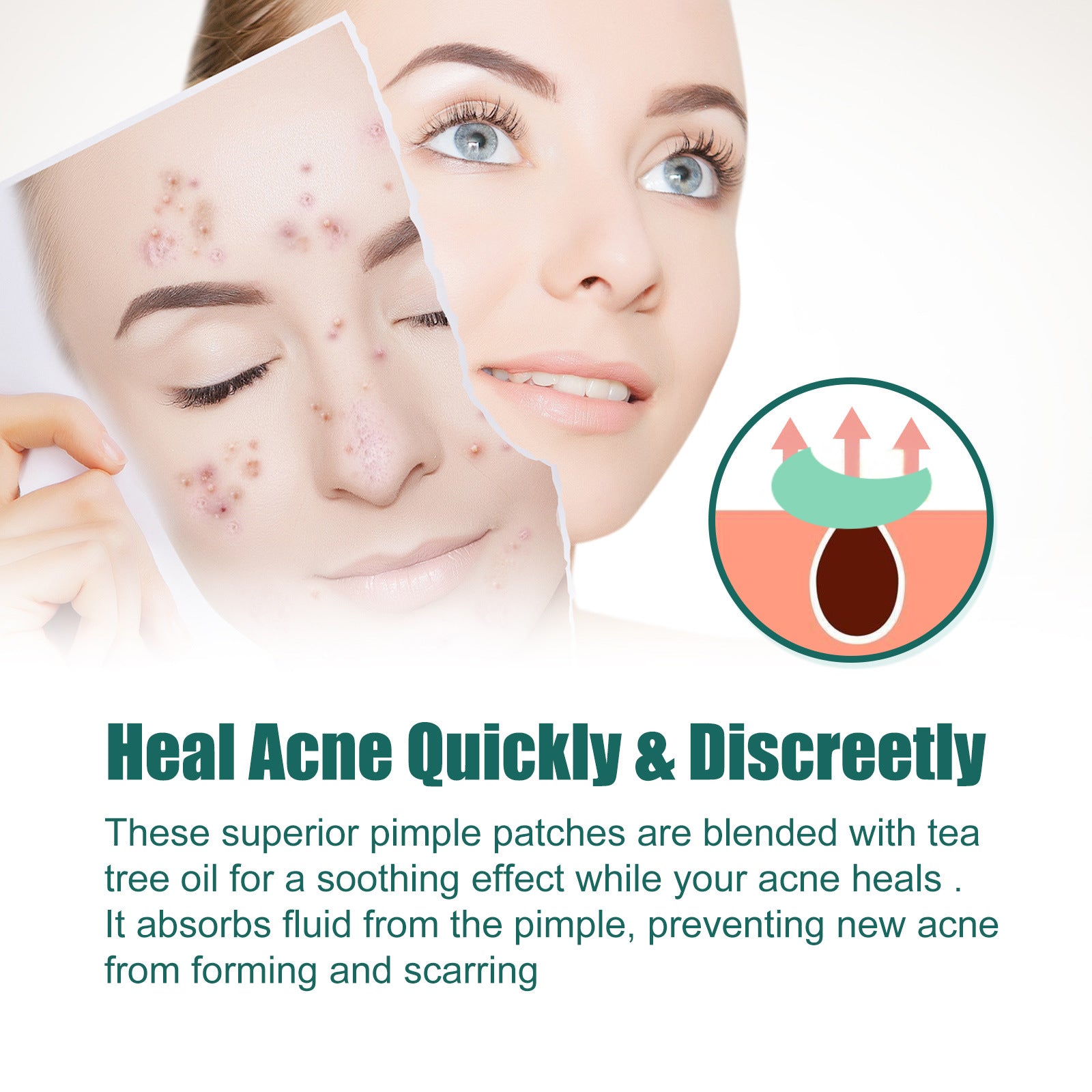 The Colorful Cleansing Acne Patch offers a vibrant, effective way to treat blemishes discreetly. Designed to absorb impurities and protect your skin from bacteria, these patches help reduce redness and promote faster healing.