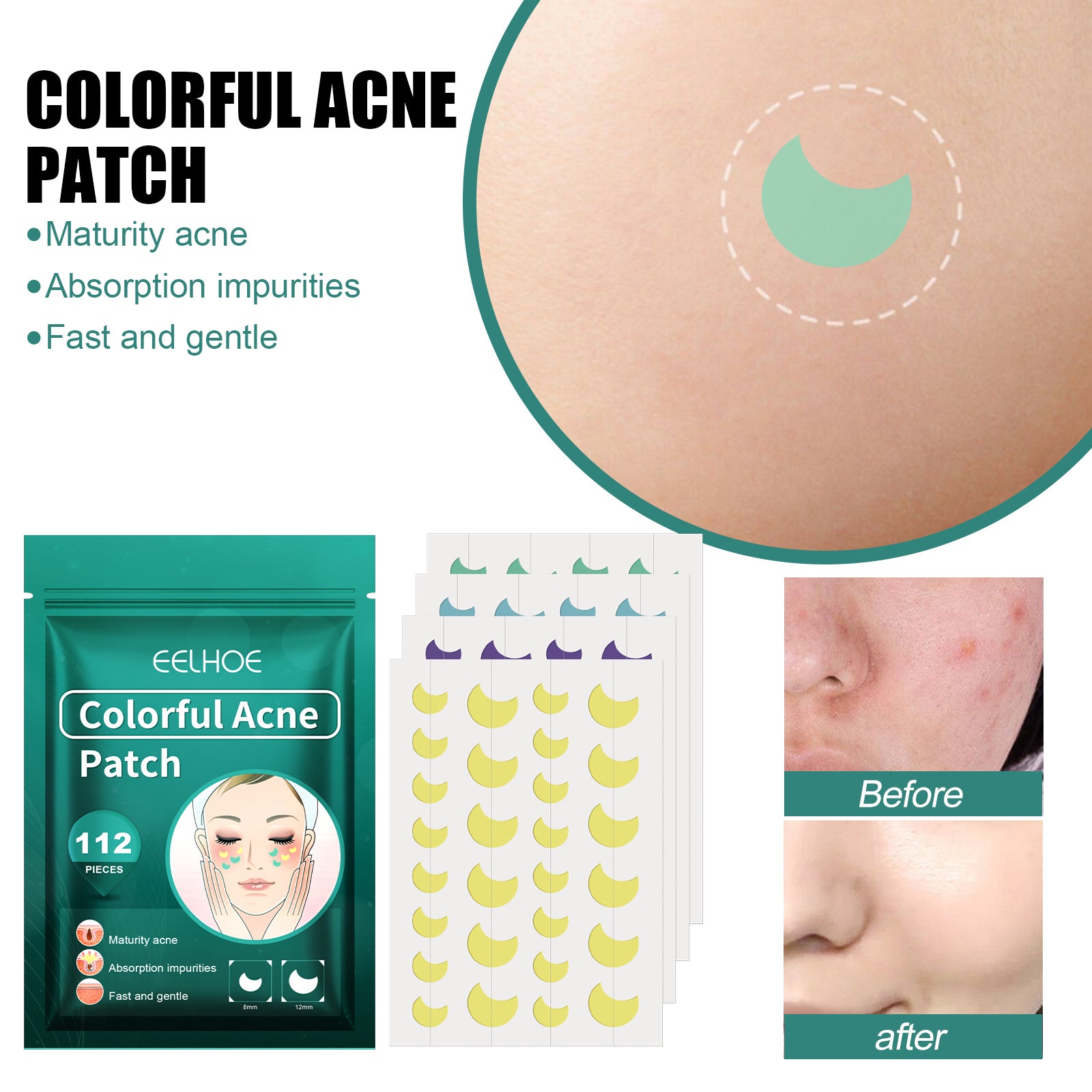 The Colorful Cleansing Acne Patch offers a vibrant, effective way to treat blemishes discreetly. Designed to absorb impurities and protect your skin from bacteria, these patches help reduce redness and promote faster healing.
