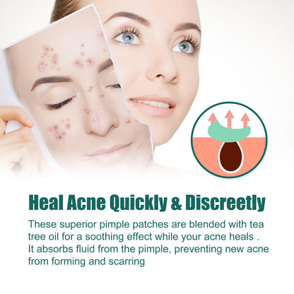 The Colorful Cleansing Acne Patch offers a vibrant, effective way to treat blemishes discreetly. Designed to absorb impurities and protect your skin from bacteria, these patches help reduce redness and promote faster healing.